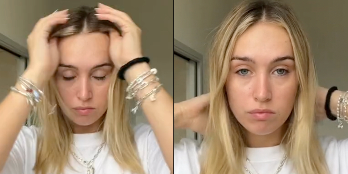 Kvindes hår var ‘så tyndt’ grundet stress: Forvandlede det på halvt år med ‘hemmelig’ olie