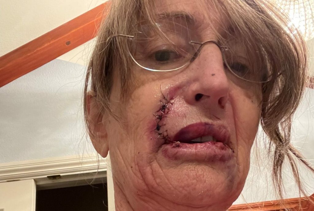 66-årig kvinde troede, at larm i køkkenet kom fra hendes søn: Fik sit livs chok, da hun opdagede hvem lyden kom fra