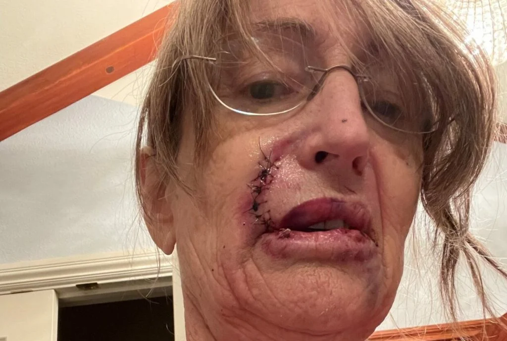 66-årig kvinde troede, at larm i køkkenet kom fra hendes søn: Fik sit livs chok, da hun opdagede hvem lyden kom fra