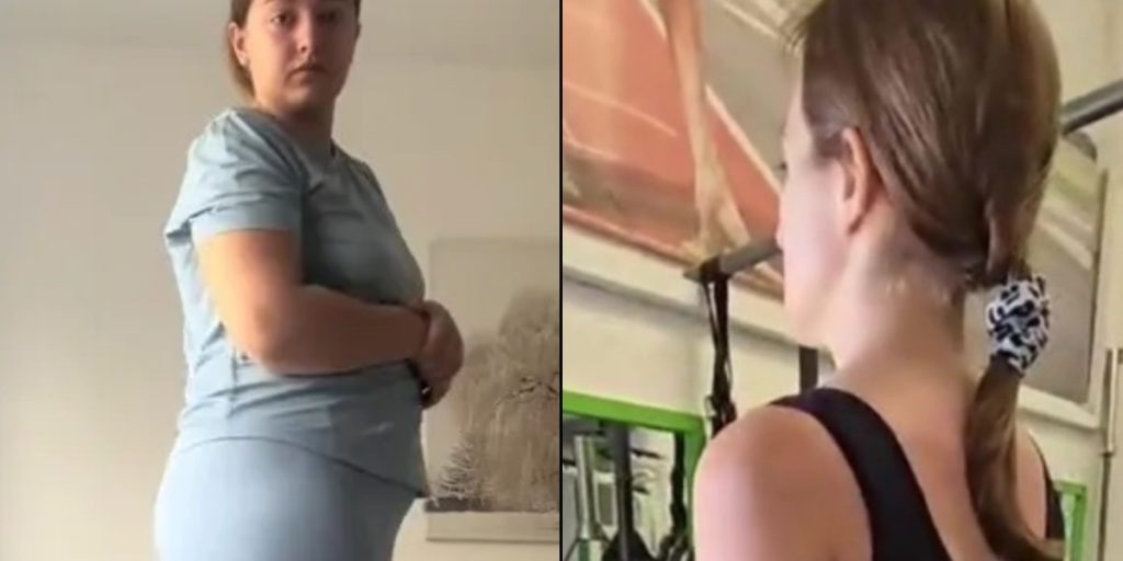 27-årig kvinde tabte 38 kg med slankemedicin – men én ting er hun ikke helt tilfreds med