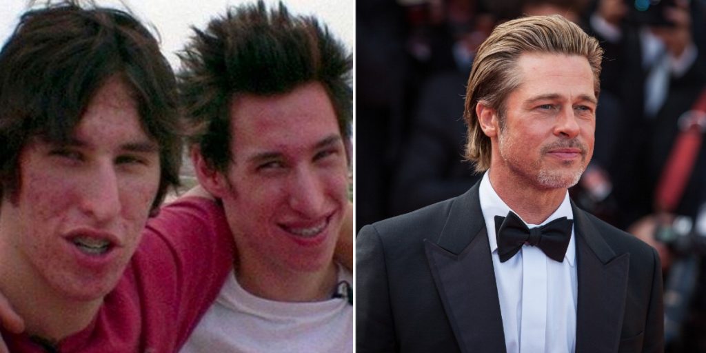 Tvillinger brugte 130.000 kroner på at ligne Brad Pitt: Sådan blev resultatet